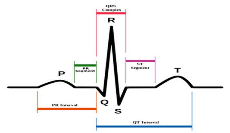 Ecg Monitor